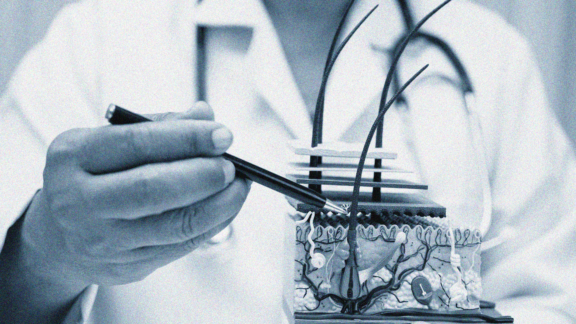 Anne Arundel Dermatology Data Breach Settlement Header Image